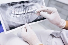 radiografia-dei-denti.jpg